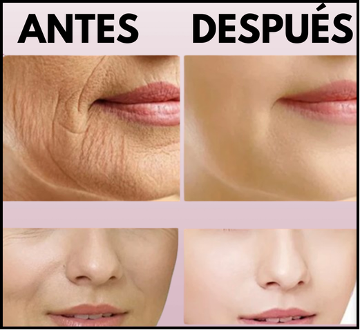 Crema Facial Anti-Edad